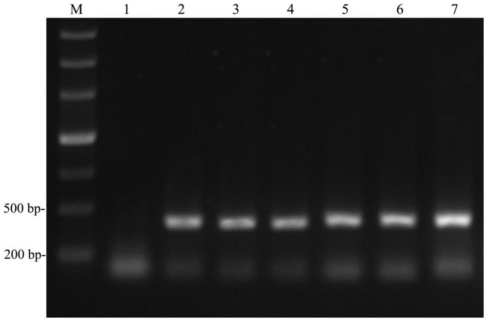 Method for detecting bursaphelenchus xylophilus, detection primer and LAMP (loop-mediated isothermal amplification) detection kit of detection primer