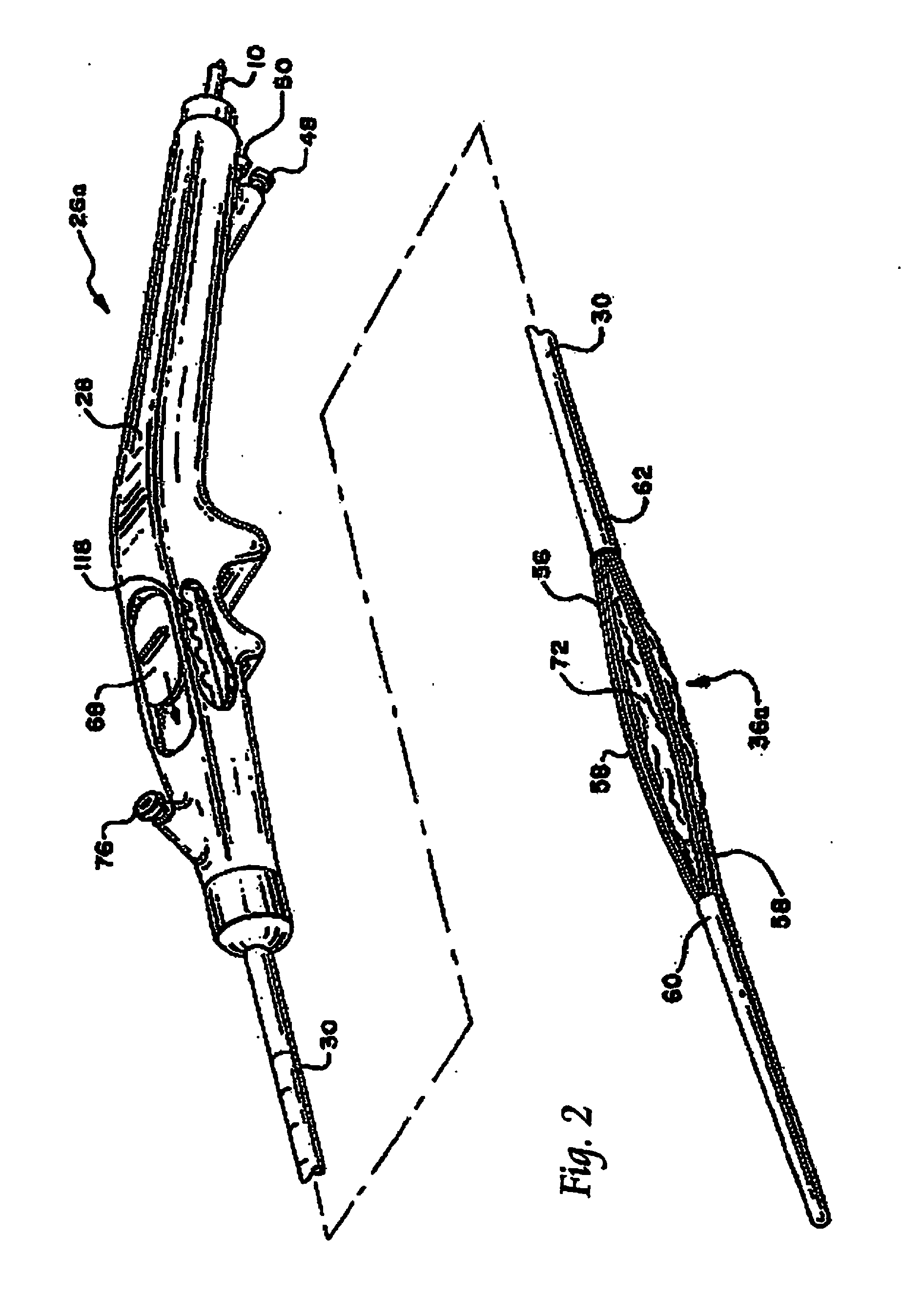 Systems and methods for treating tissue with radiofrequency energy