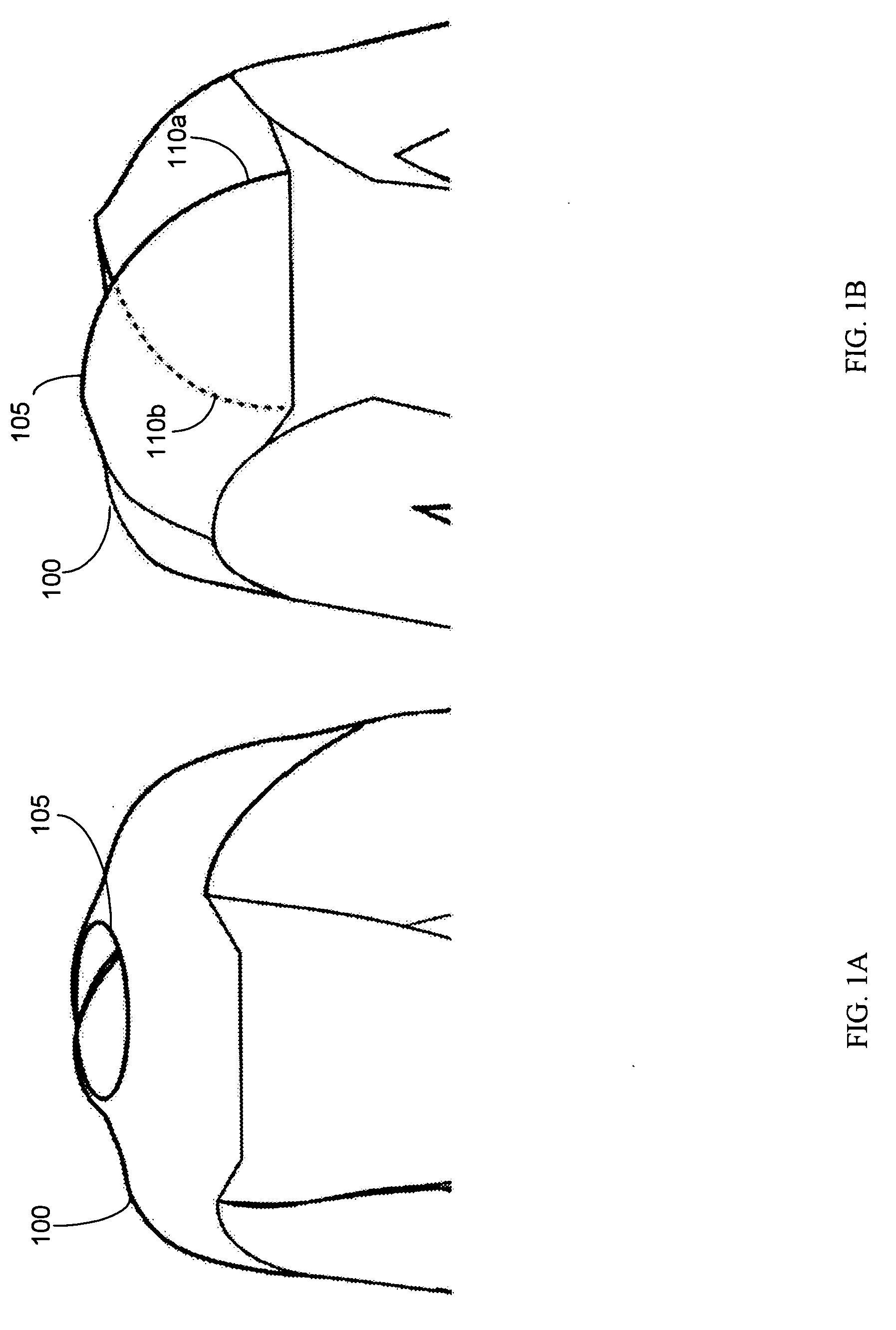 Neck closure system for a wetsuit