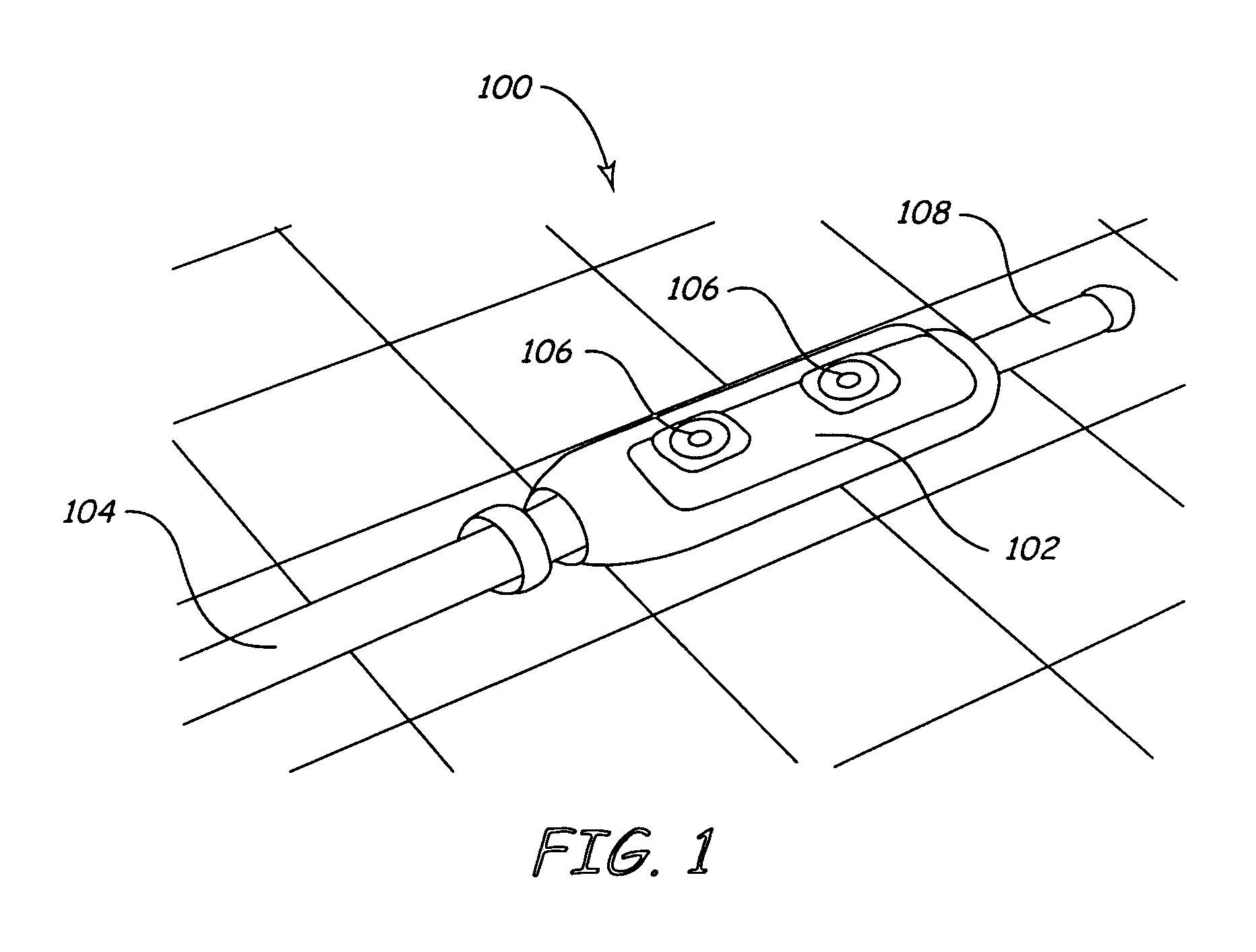 Method and apparatus for shunting induced currents in an electrical lead