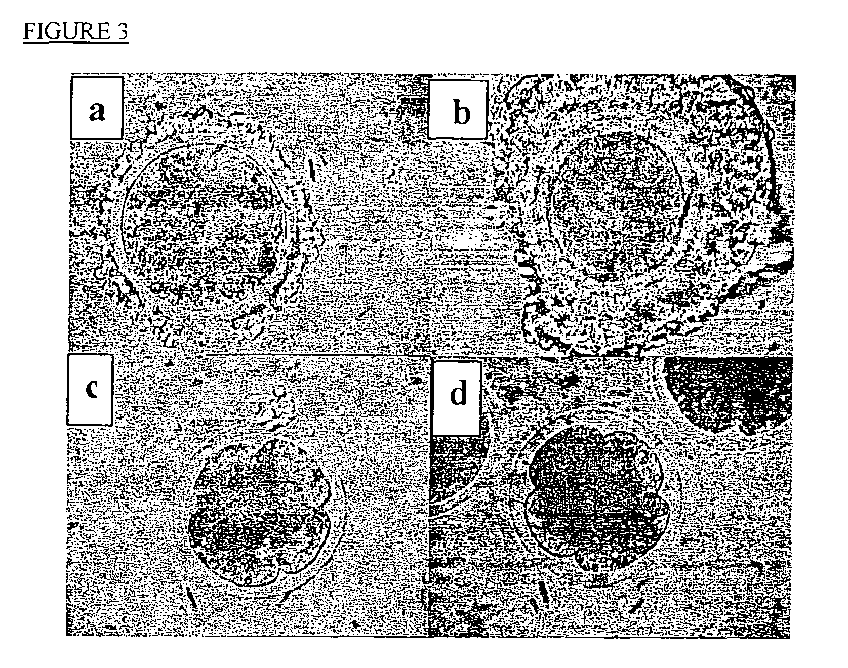 Methods of preserving functionality of an organ, preserving fertility of a patient undergoing a treatment expected to cause sterility and assuring a supply of viable gametes for future use