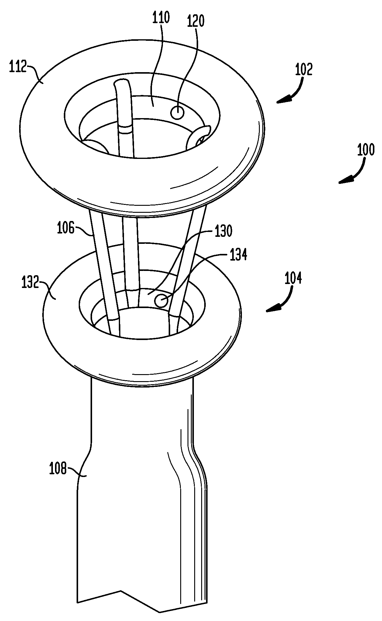 Systems and methods for treatment of obesity and type 2 diabetes