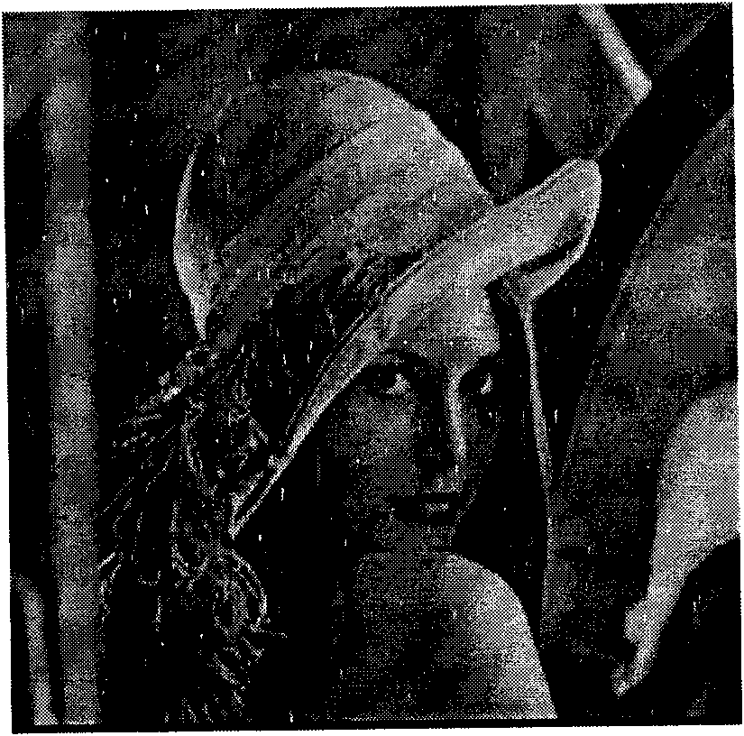 Method for eliminating image impulse noise based on differential image detection and filtration by multiple windows