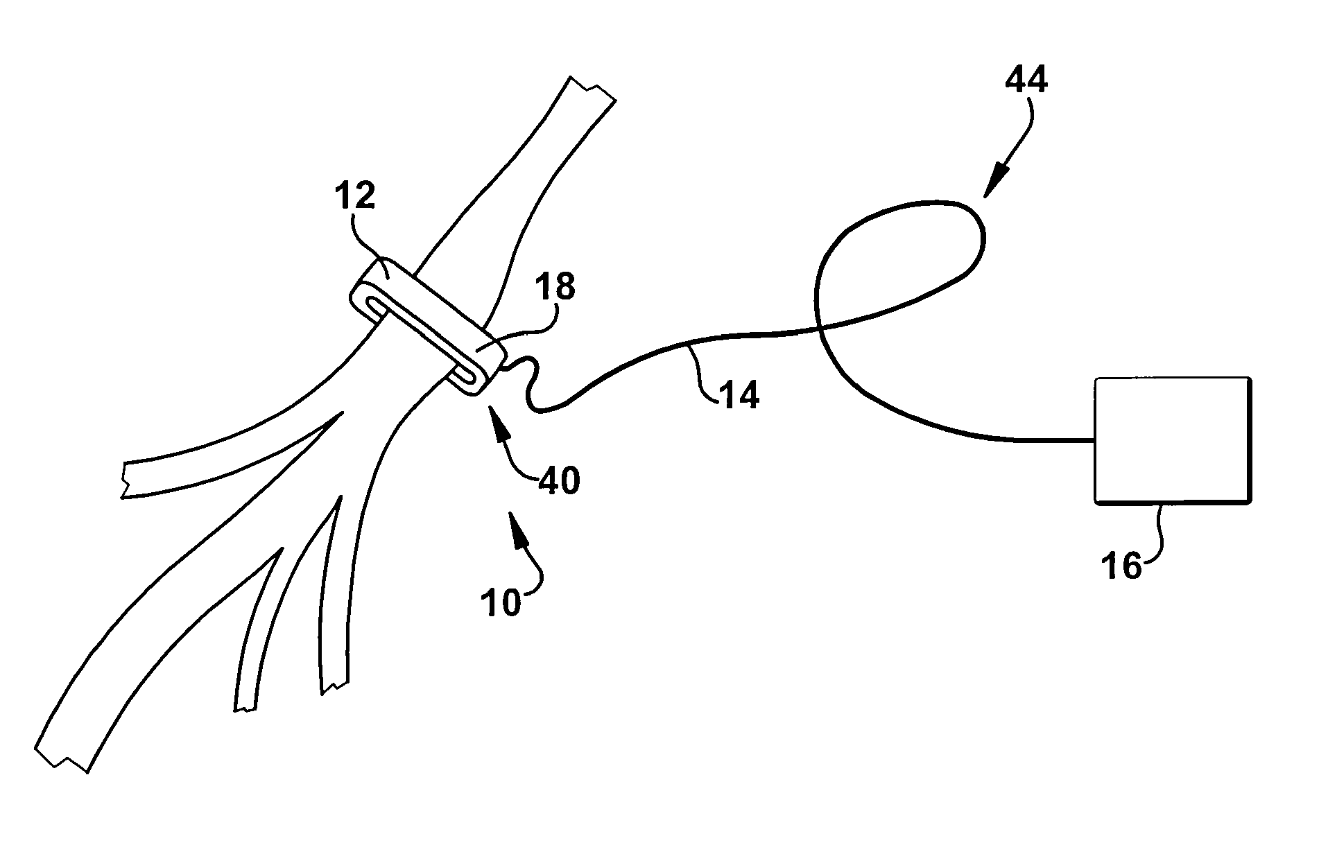 Nerve cuff for implantable electrode