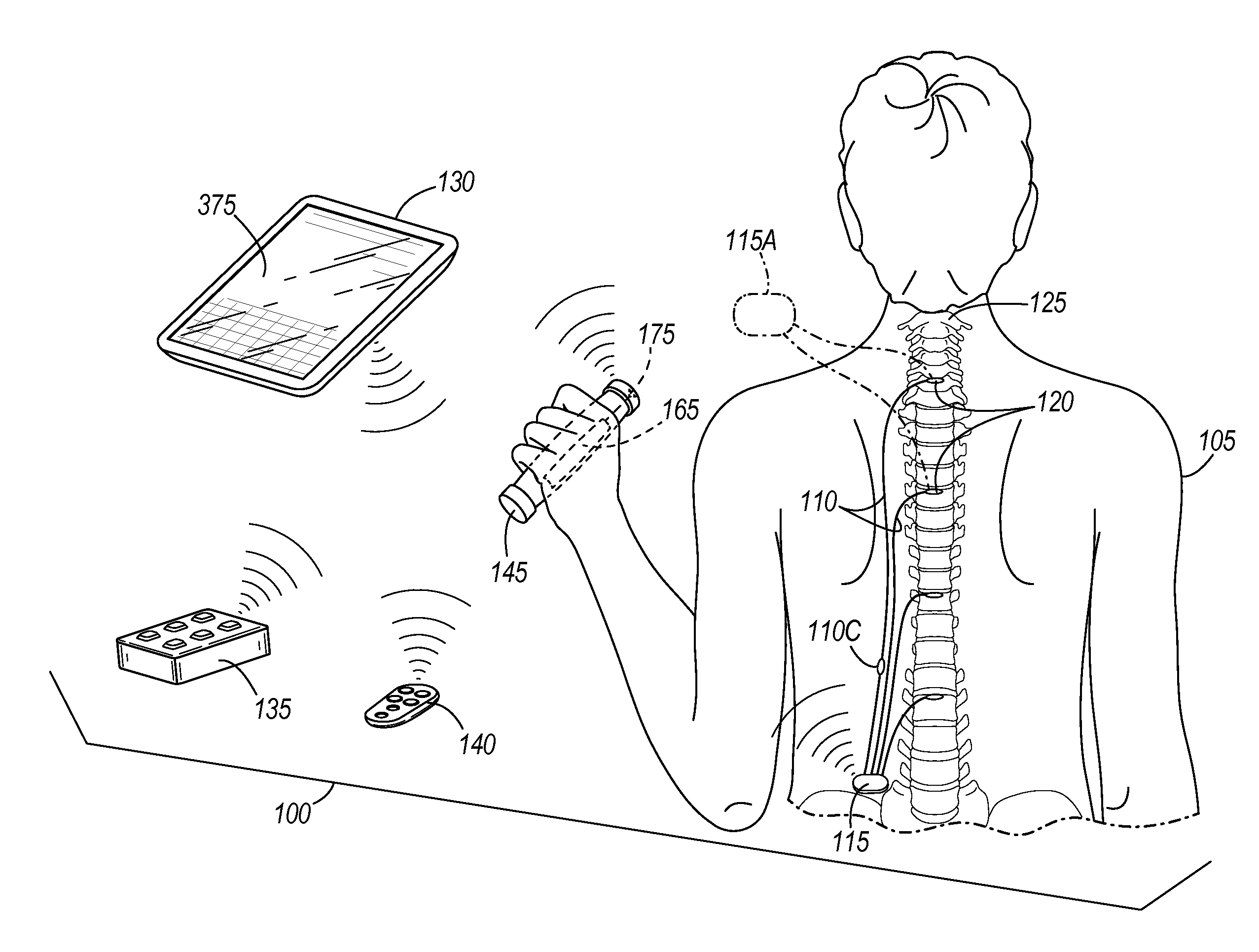 Configuring electrical stimulation to treat a patient