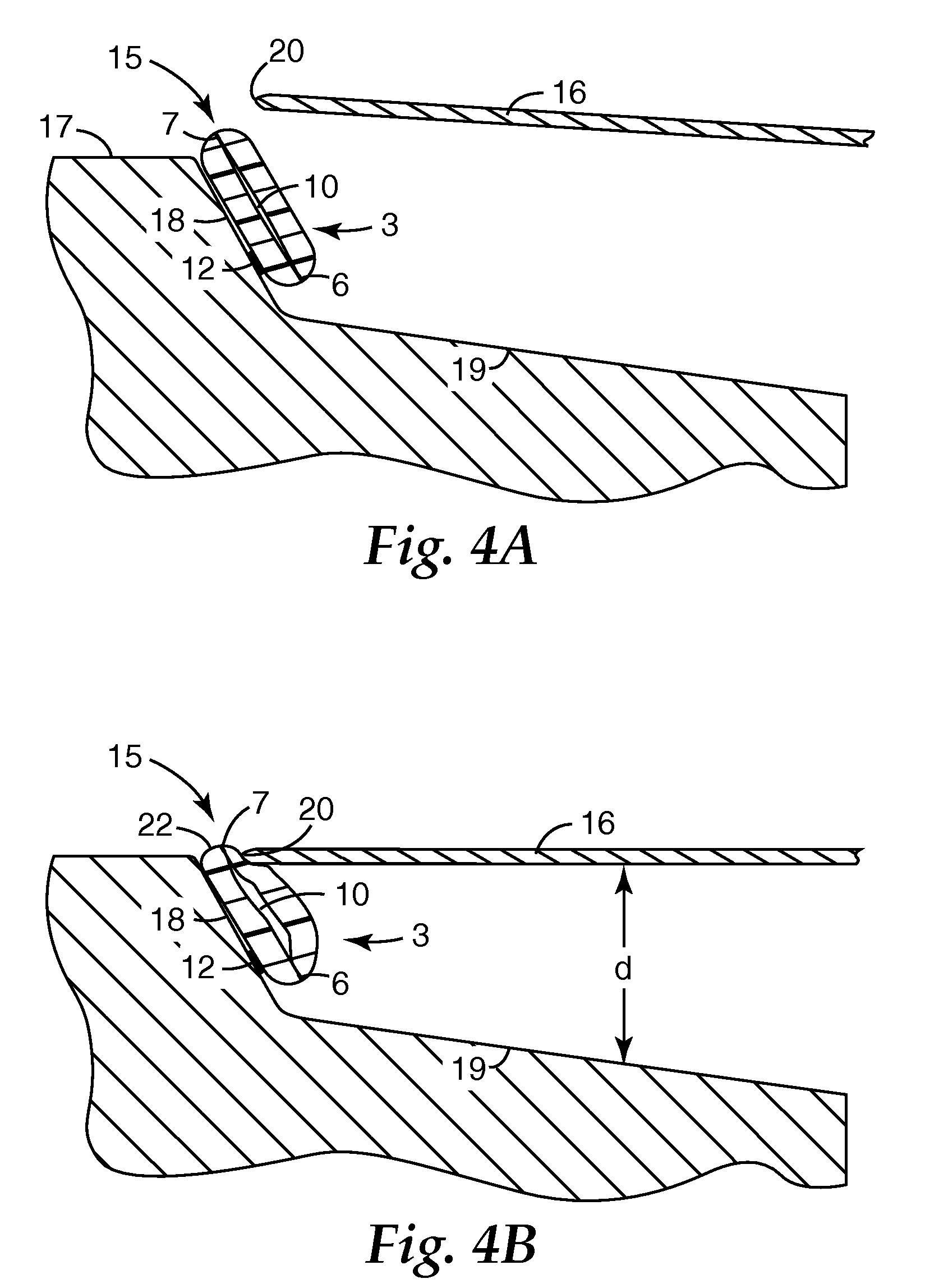 Masking article