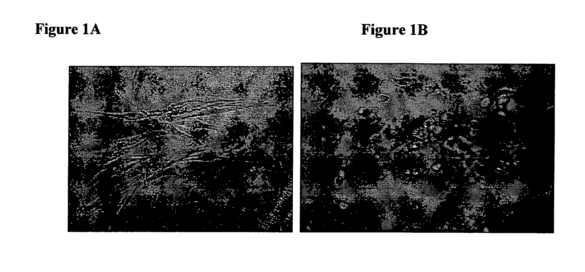 Amphiphilic peptide matrices for treatment of osteoporosis