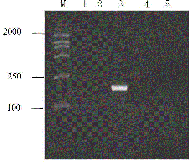 Method for detection of viral hemorrhagic sepsis virus based on liquid chip