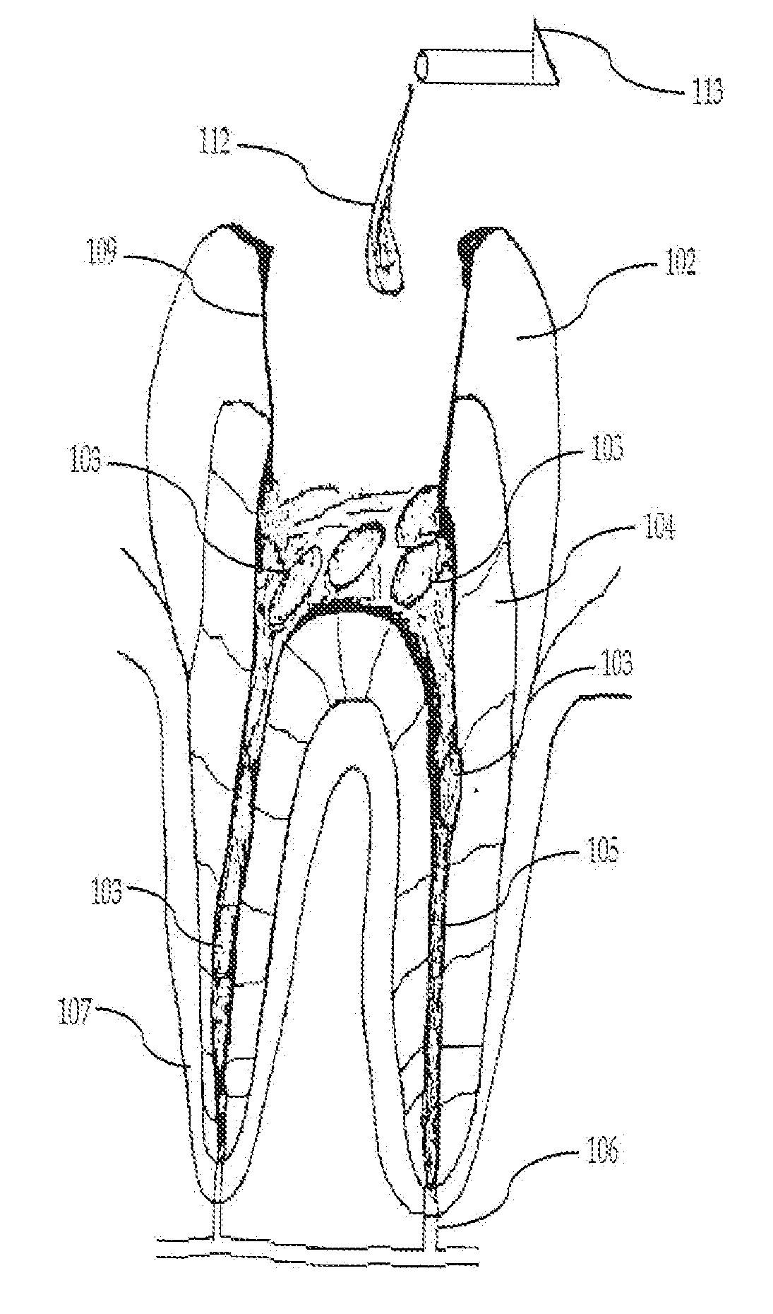 Composition and Method for Using Medicament for Endodontic Irrigation, Stem Cell Preparation and Tissue Regeneration