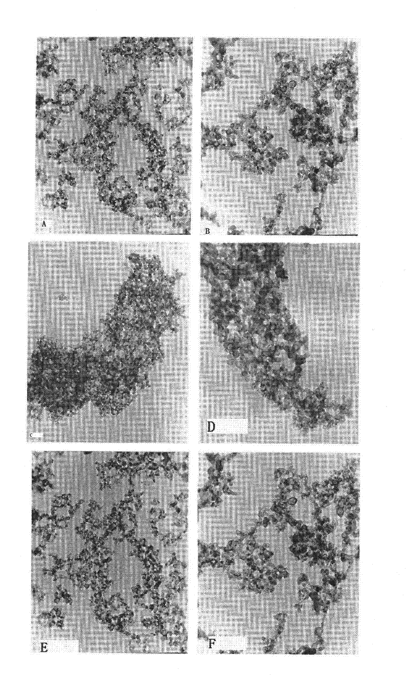 Aluminium phosphate adjuvant and preparation method thereof.