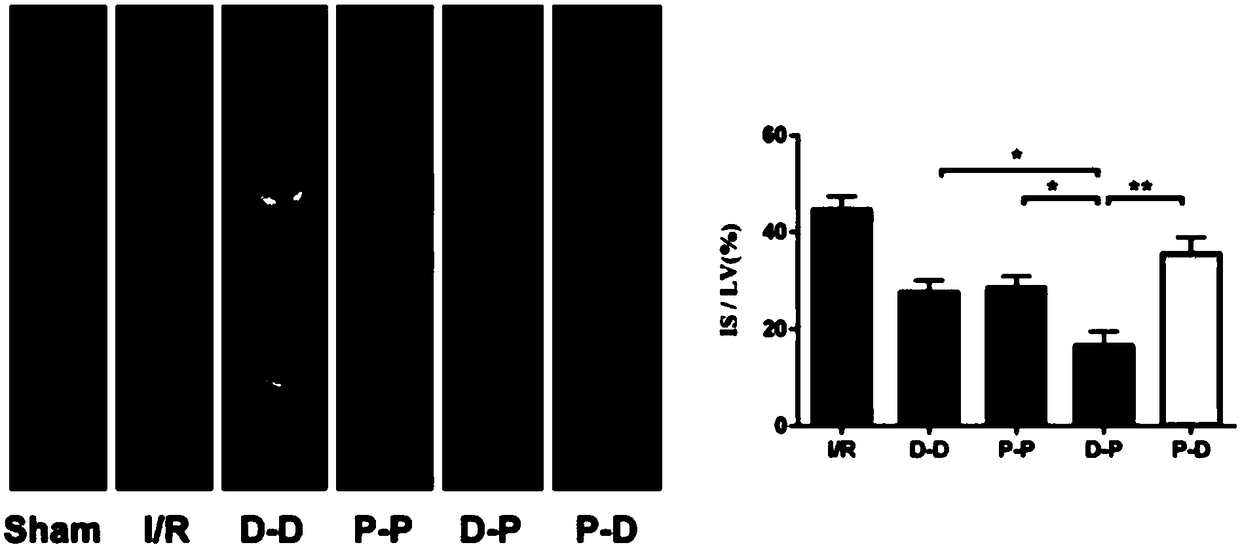 Application of protective medicine for ischemia reperfusion injury prepared by mitochondrial complex I reversibility inhibitor and active oxygen scavenger