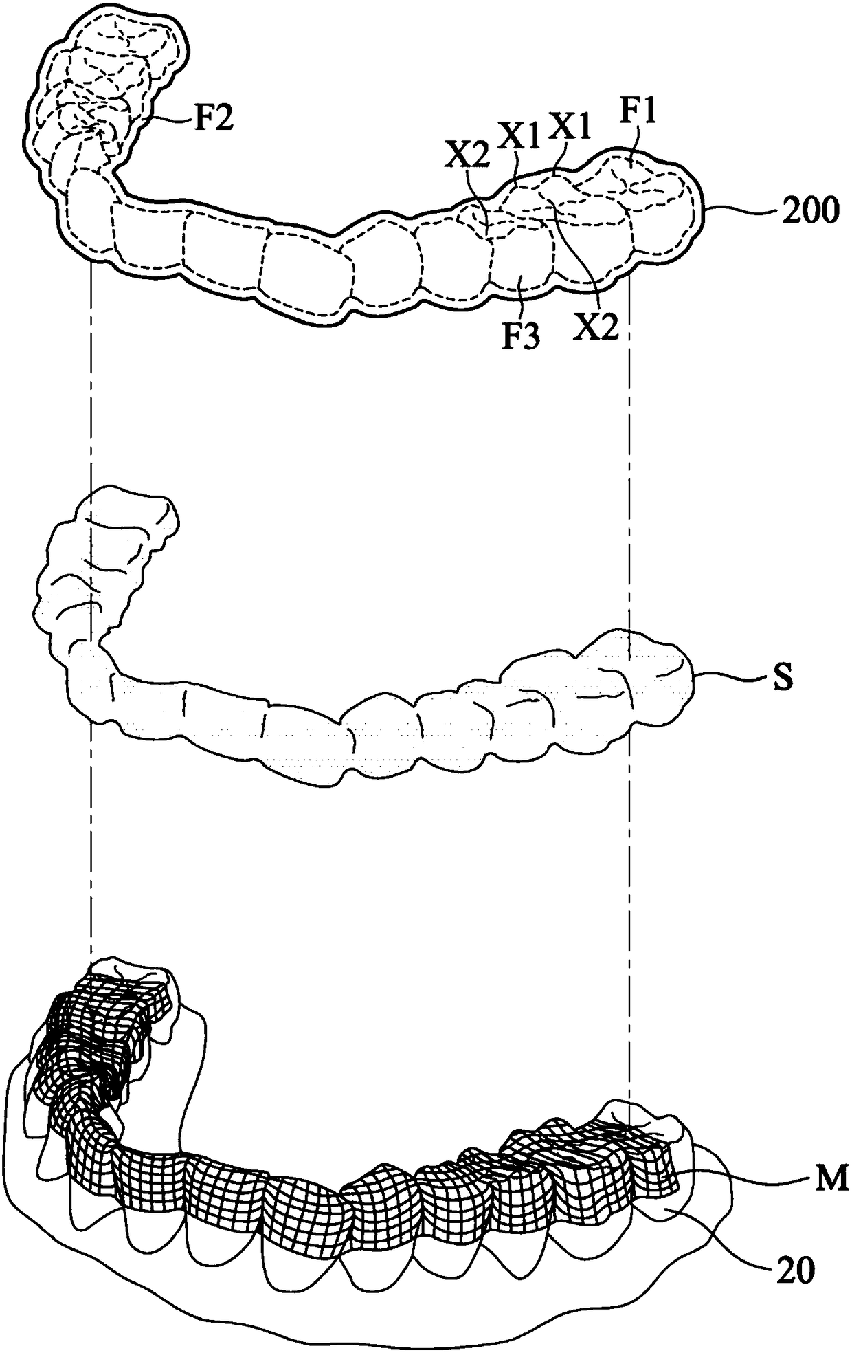 Masticatory orthodontic device and shape memory mesh