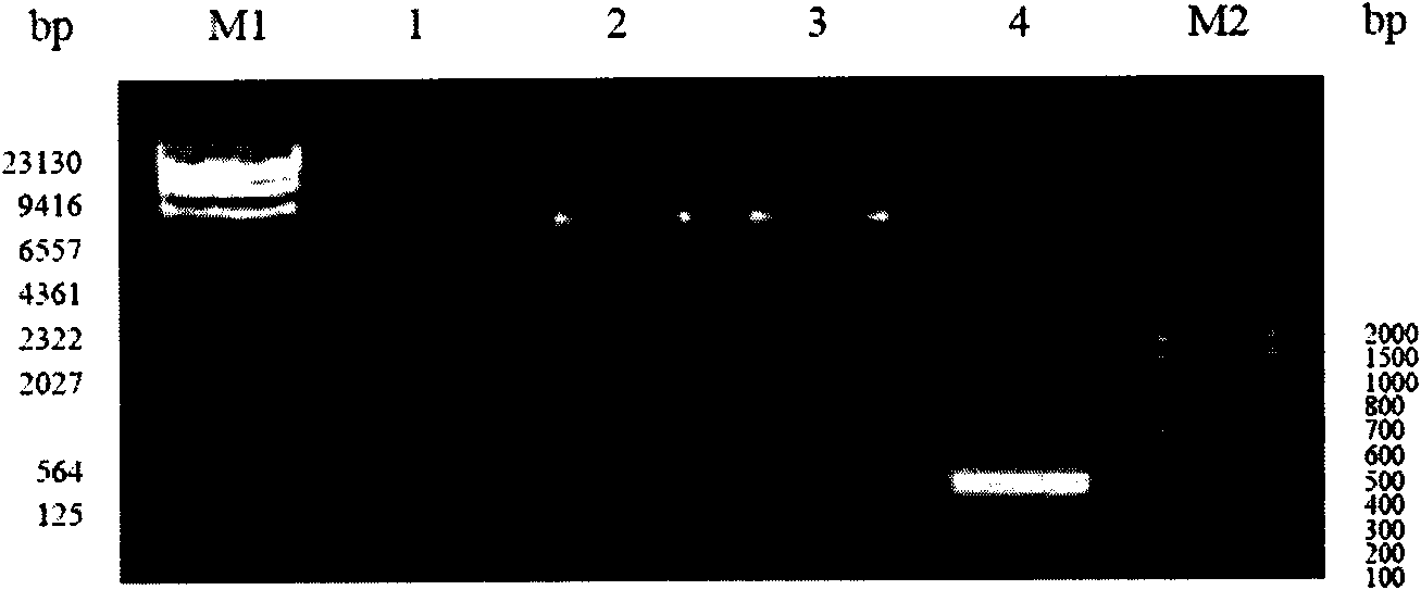 Multi-epitope recombinant protein of epstein-barr (EB) virus latent membrane protein 2 and application thereof