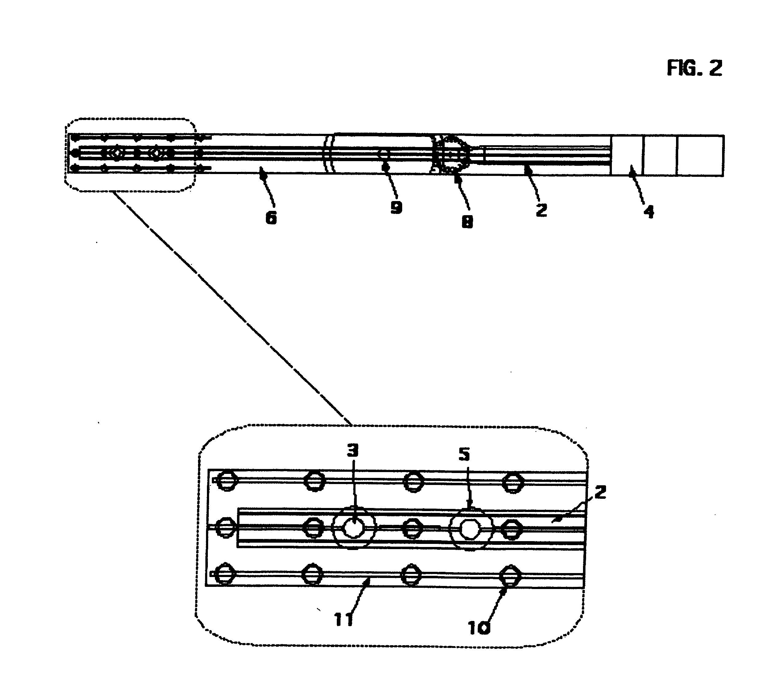 Coplanar X-ray guided aiming arm for locking of intramedullary nails