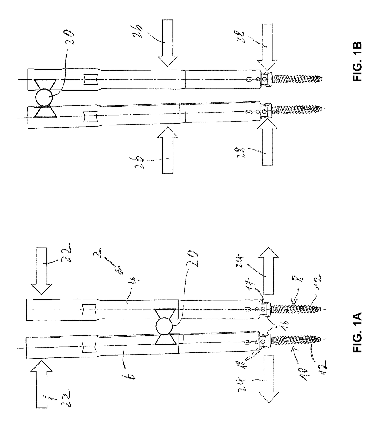 Device for carrying out a distraction or a compression of vertebral bodies during spinal surgery