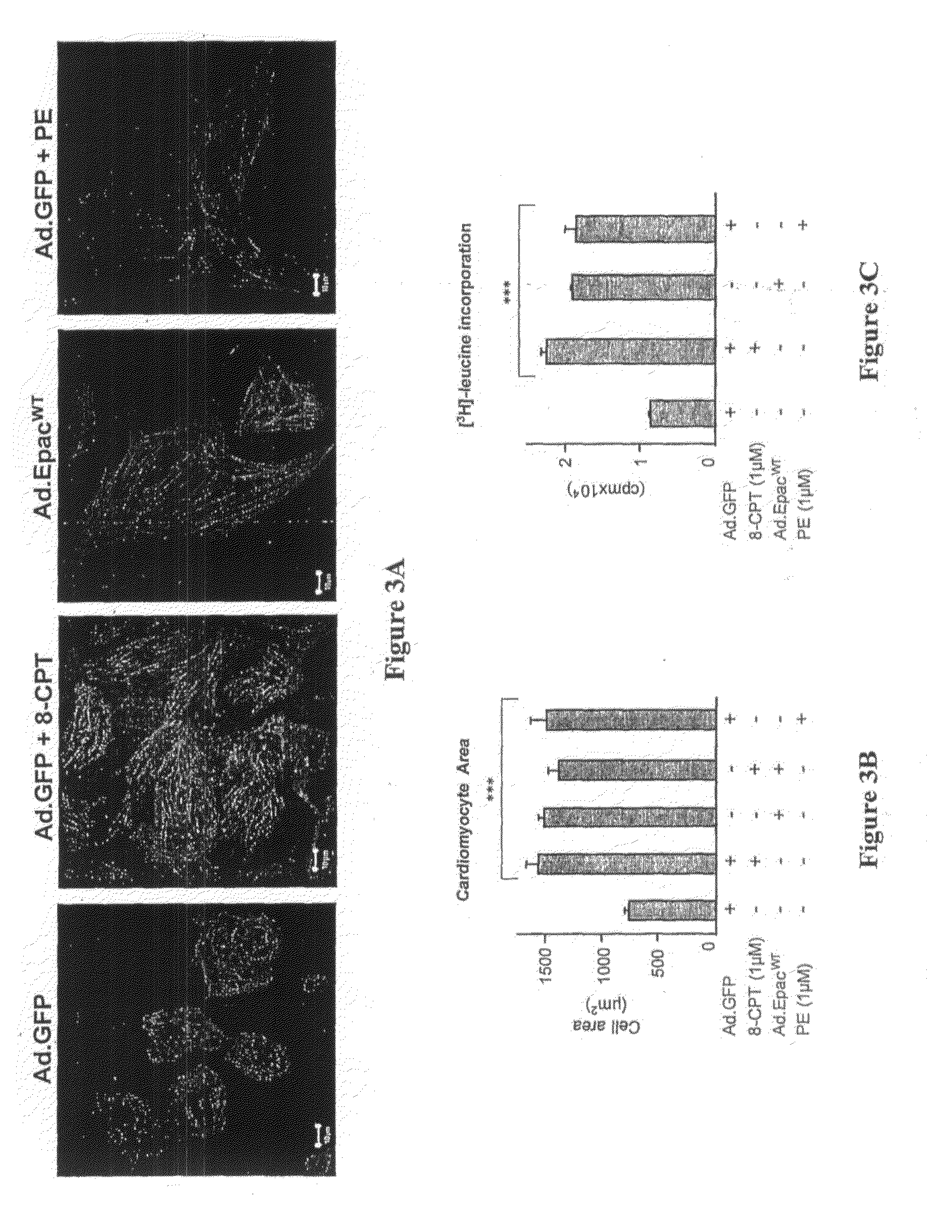 Use Of An Antagonist Of Epac For Treating Human Cardiac Hypertrophy