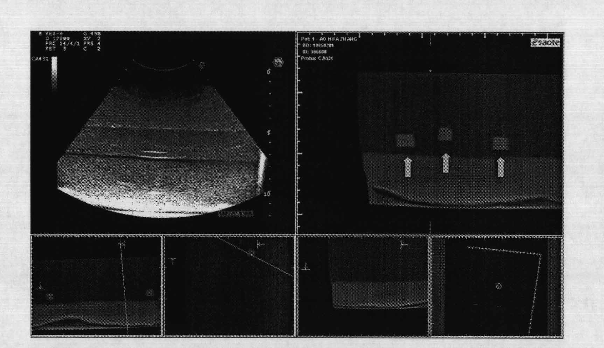 Model for carrying out virtual navigation and assisting tumor tissue biopsy process being unable to be displayed ultrasonically