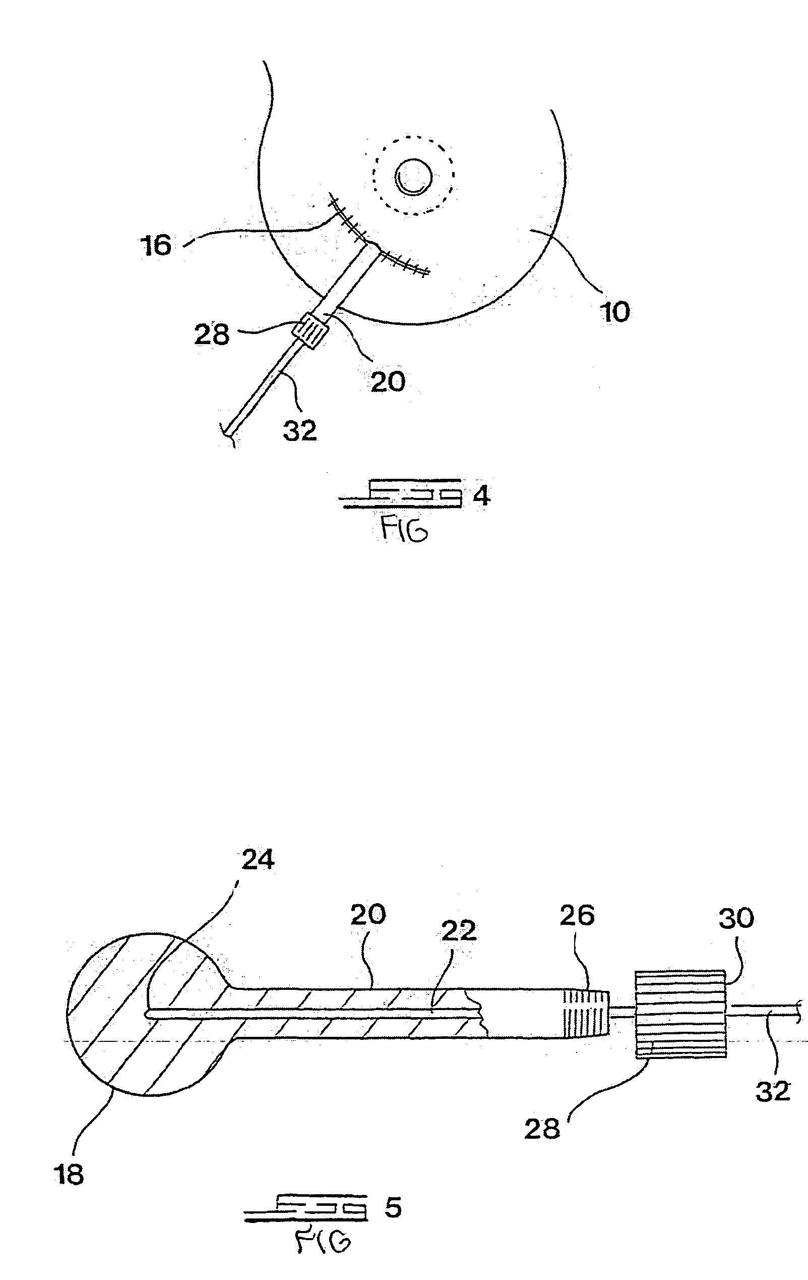 Devices and methods to conform and treat body cavities