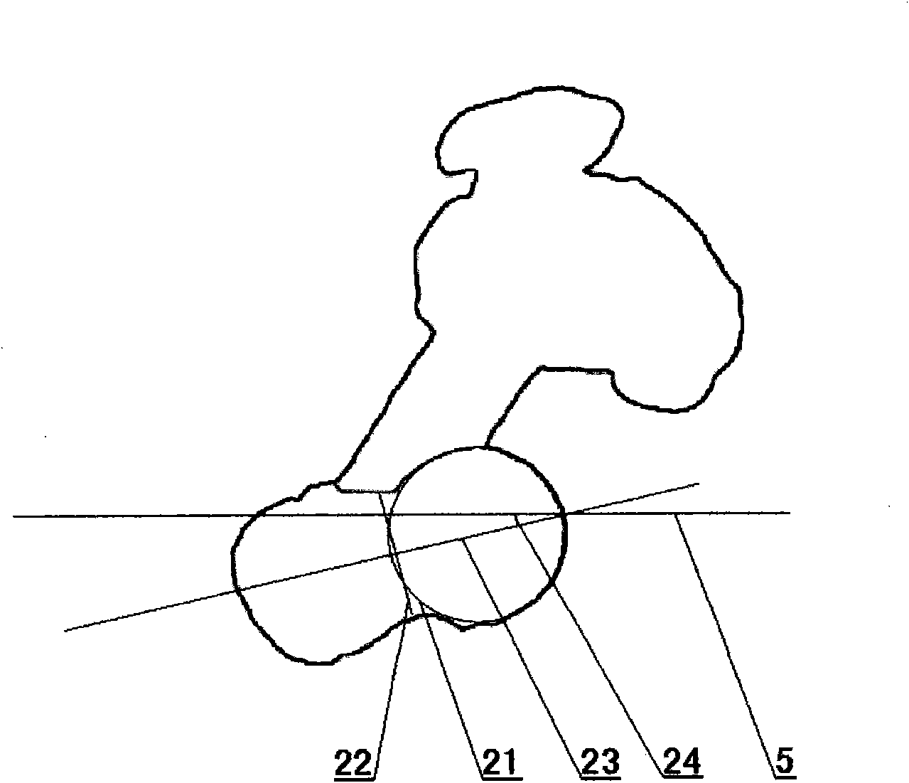 Method for measuring femoral head-neck spatial angles