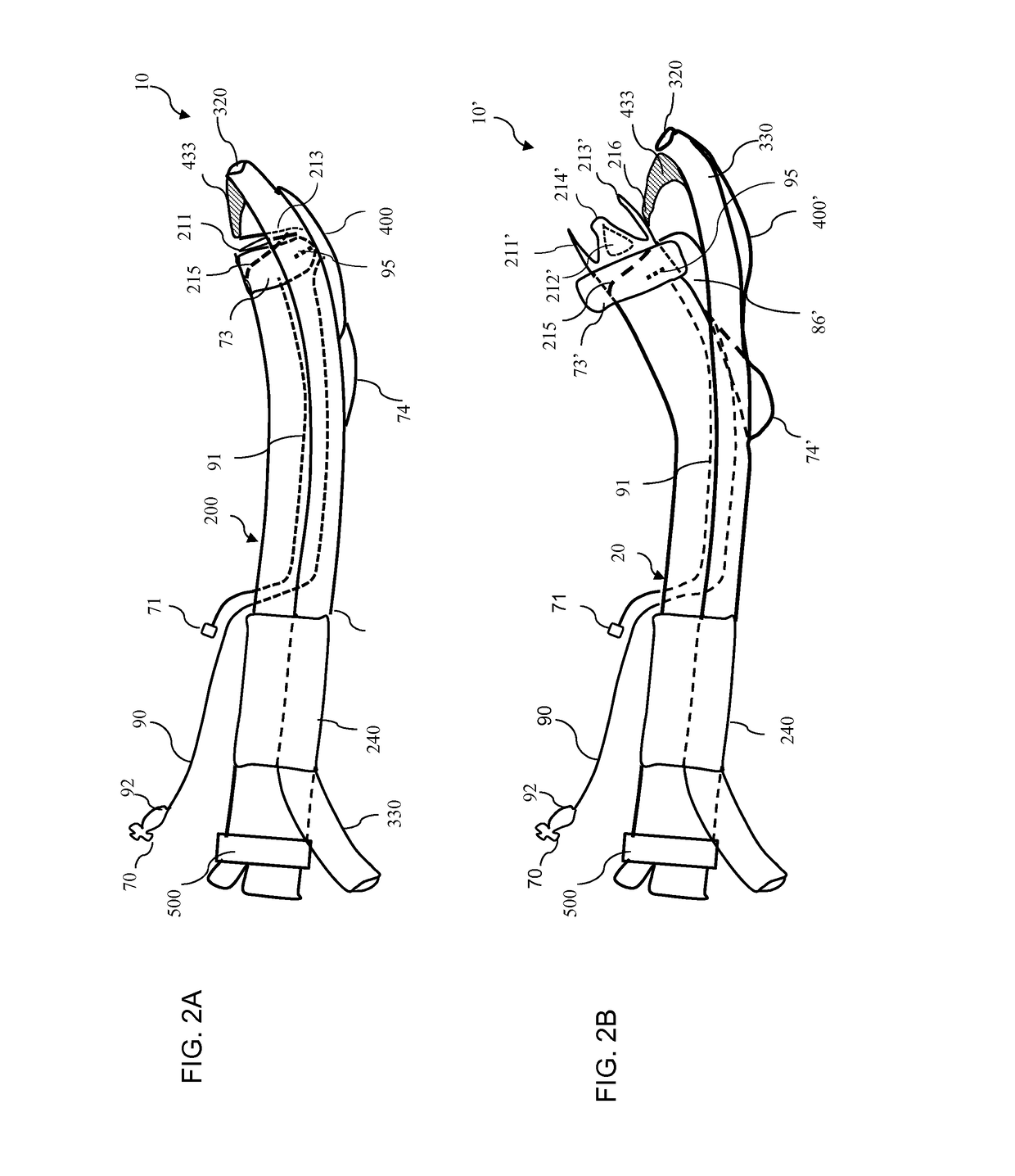 Laryngascope free airway device