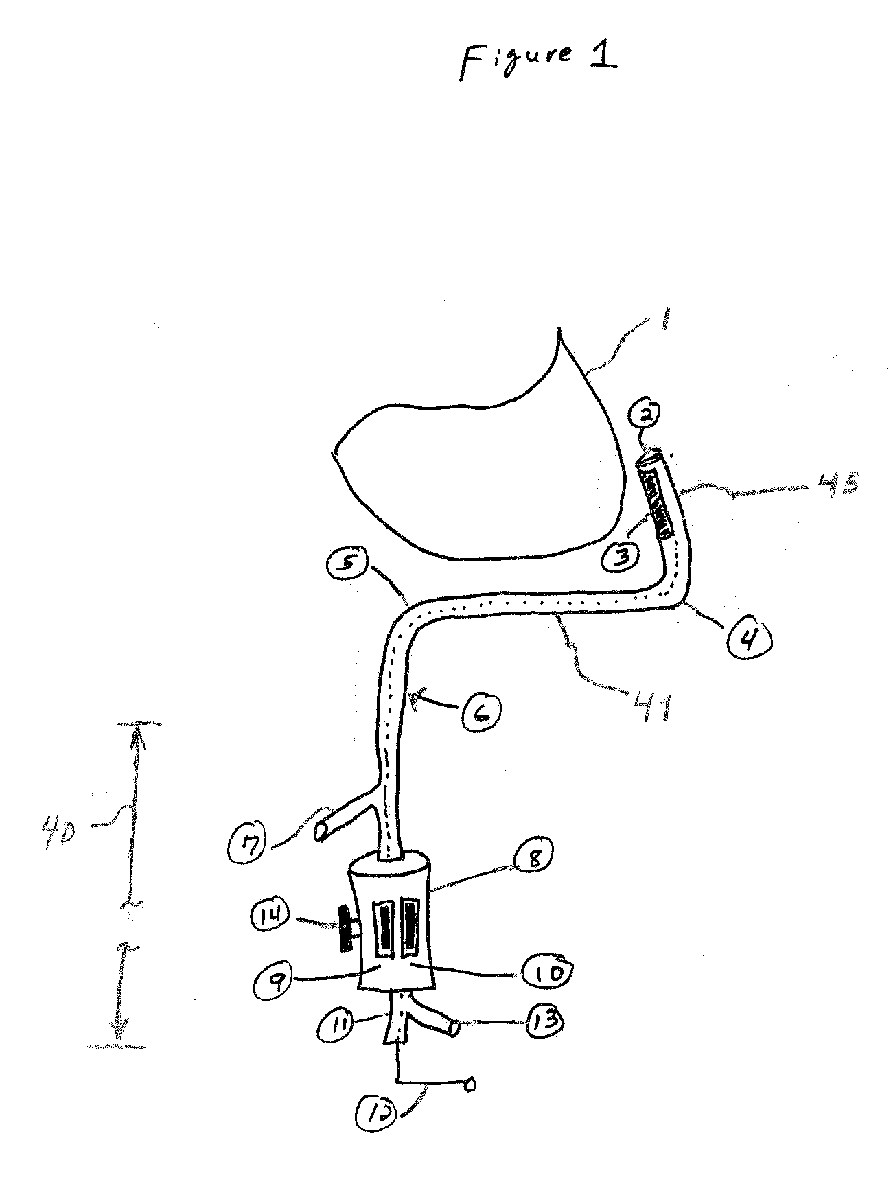 Electrode Catheter for Ablation Purposes and Related Method Thereof