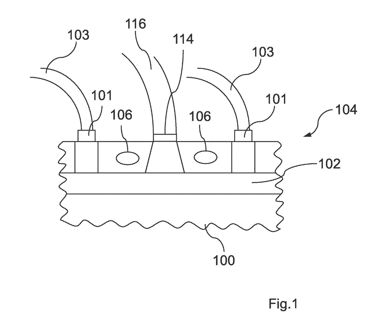 System, apparatus, and method of providing tattoo fading and removal