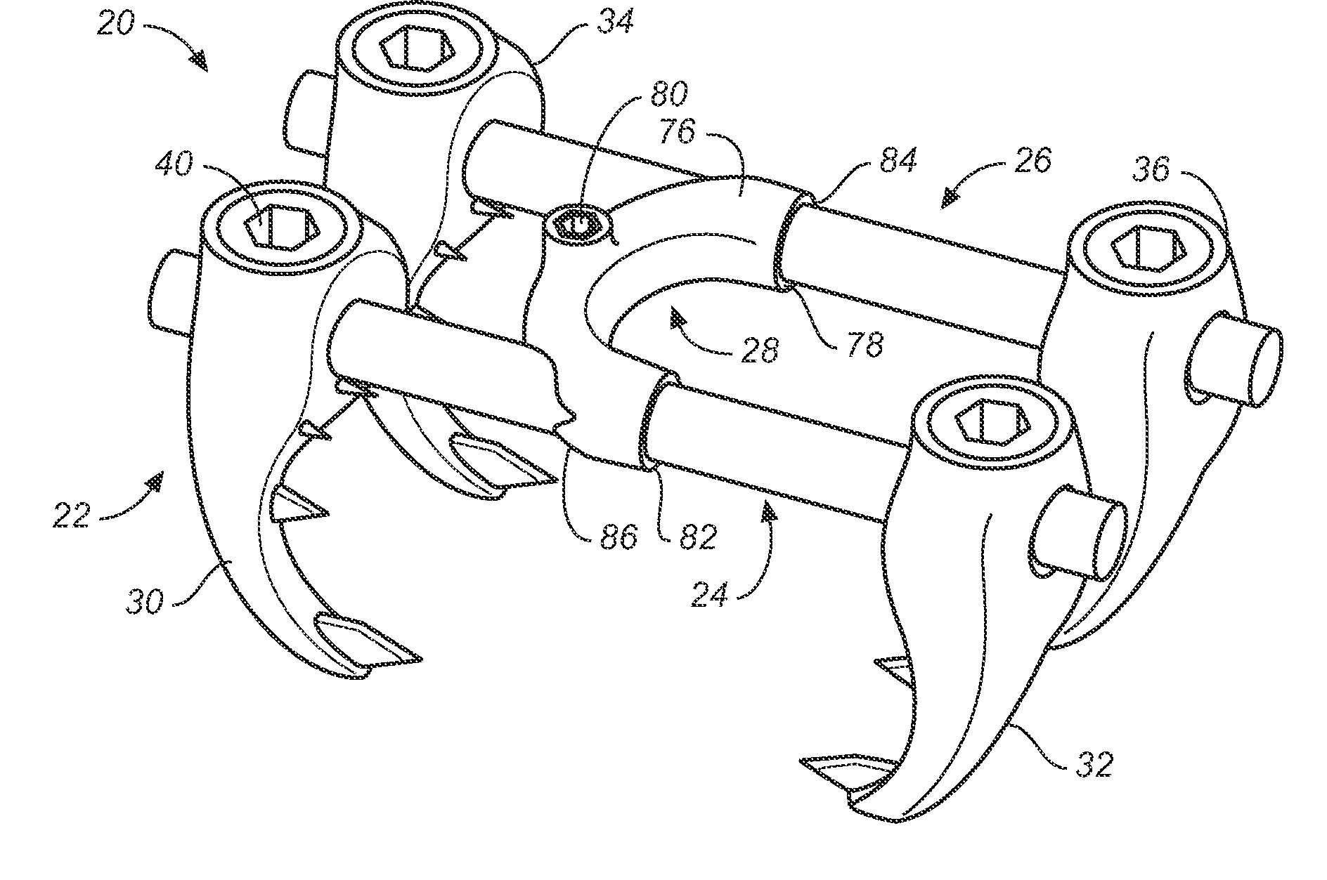 Implant system and method to treat degenerative disorders of the spine