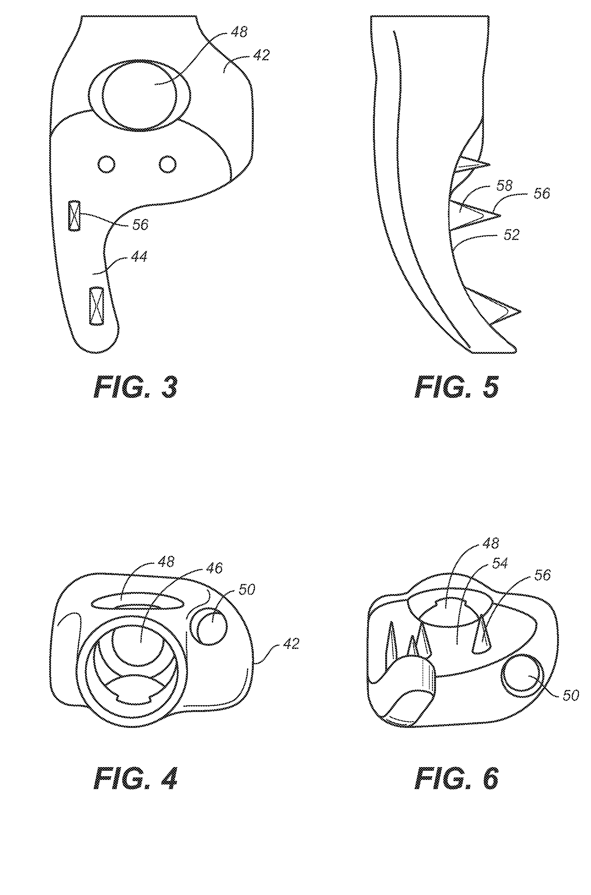 Implant system and method to treat degenerative disorders of the spine