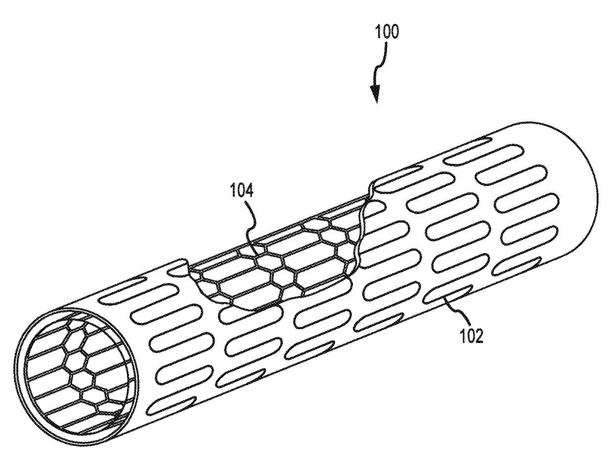 Post-implantation contractible or expandable devices and method of using and making the same