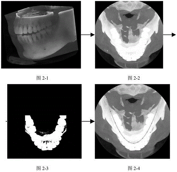 Method for extracting panoramic image from three-dimensional conical beam CT data of dentistry department