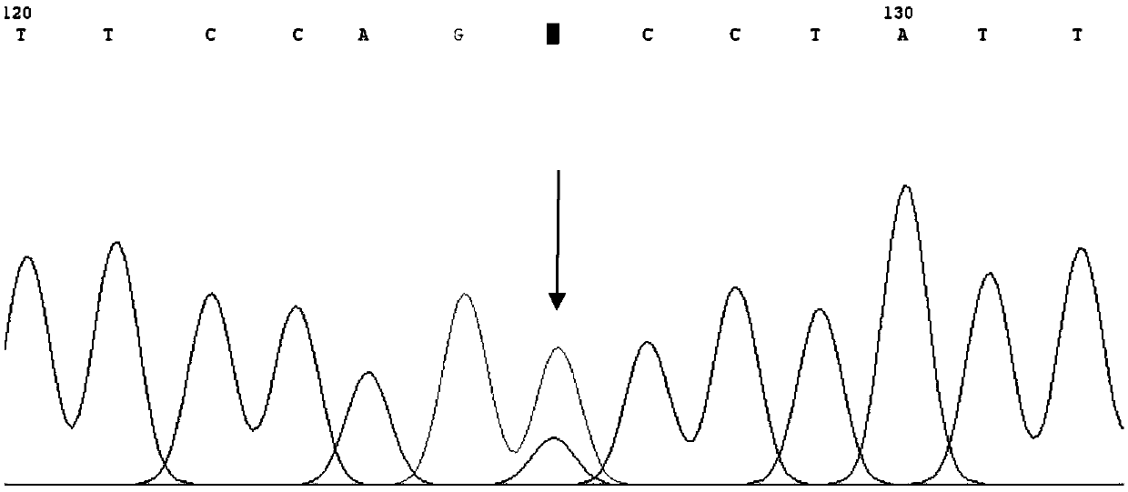 Large vestibular aqueduct syndrome/Pendred syndrome infective gene SLC26A4 mutation detection reagent kit