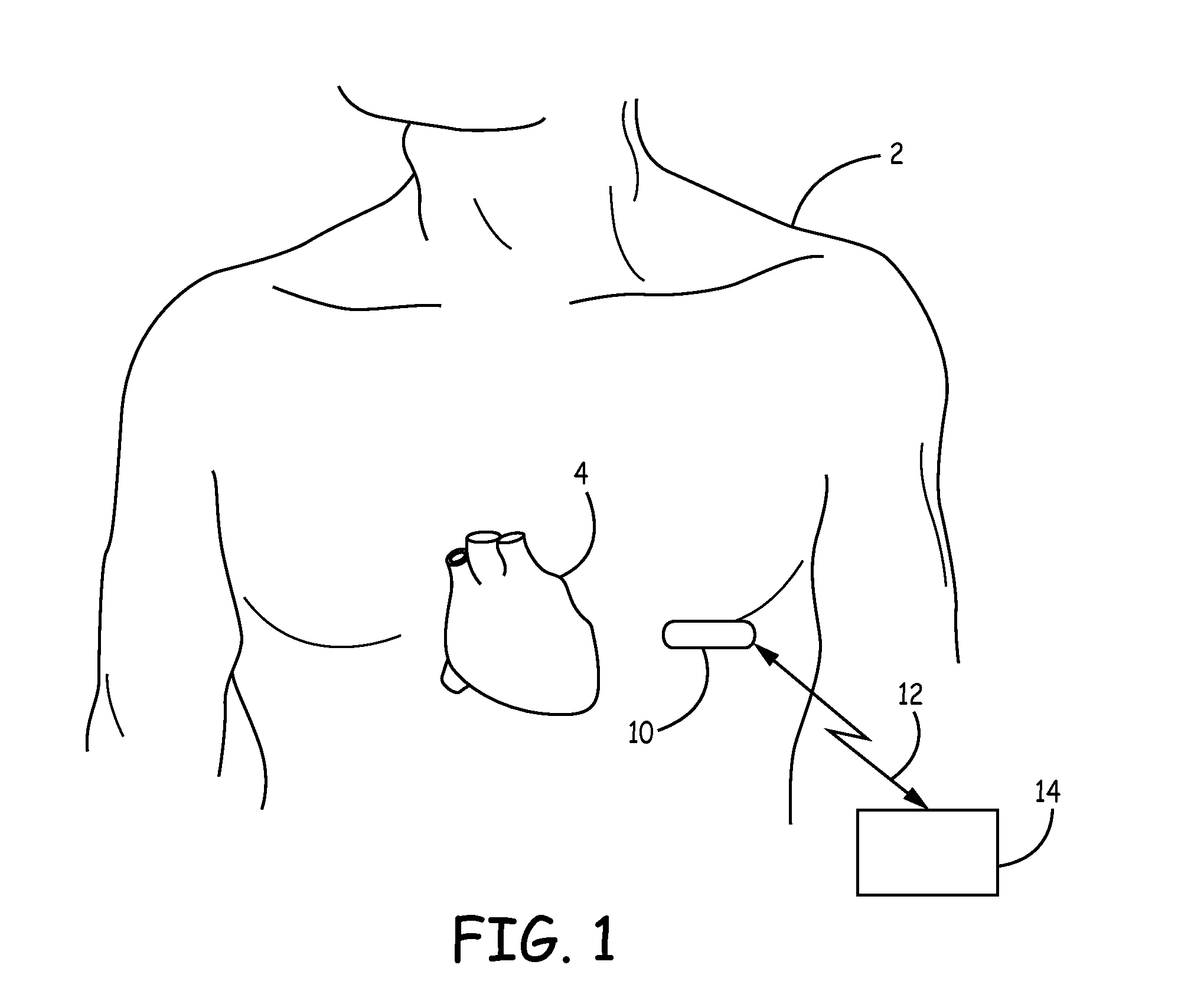 Supply noise rejection in implantable medical devices