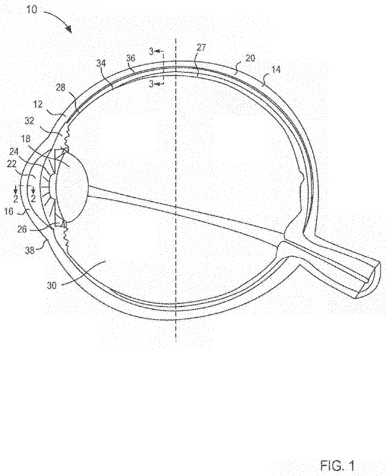 Compositions and methods for treating noninfectious uveitis