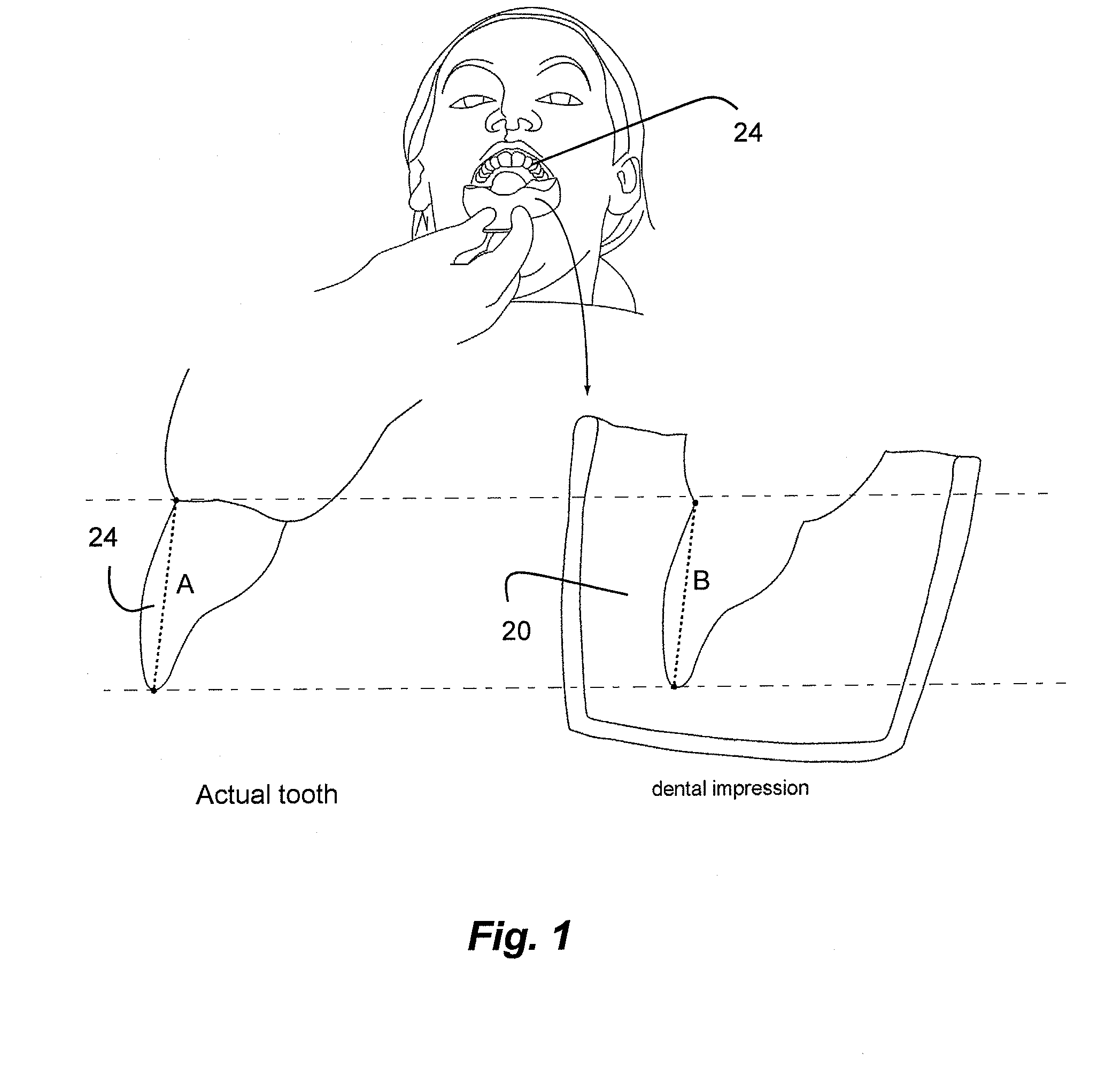 Method for dimensional adjustment for dental scan, digitized model or restoration