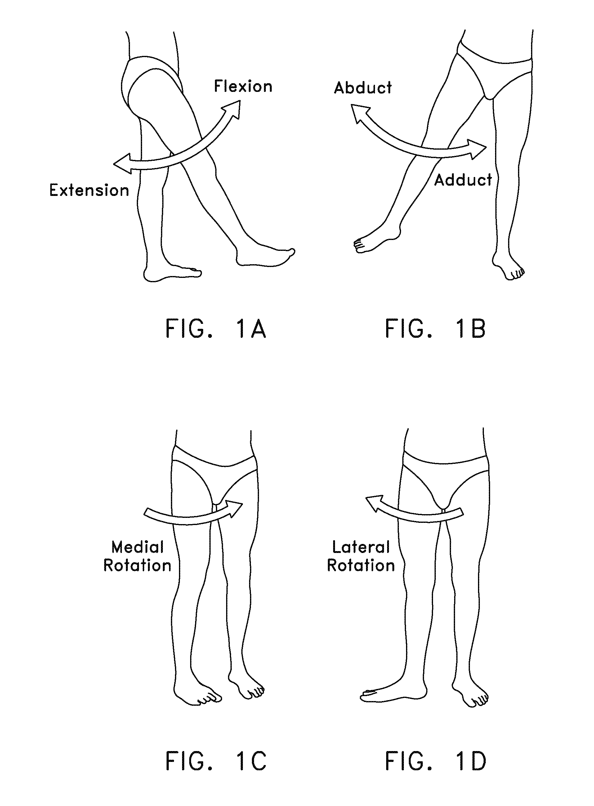 Method and apparatus for distracting a joint, including the provision and use of a novel fluid joint spacer