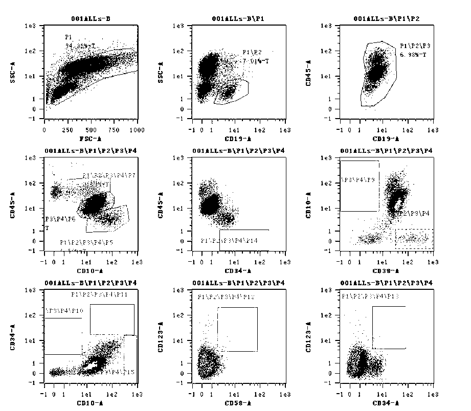 Kit for detecting related immunophenotyping of B-cell acute lymphoblastic leukemia and application thereof