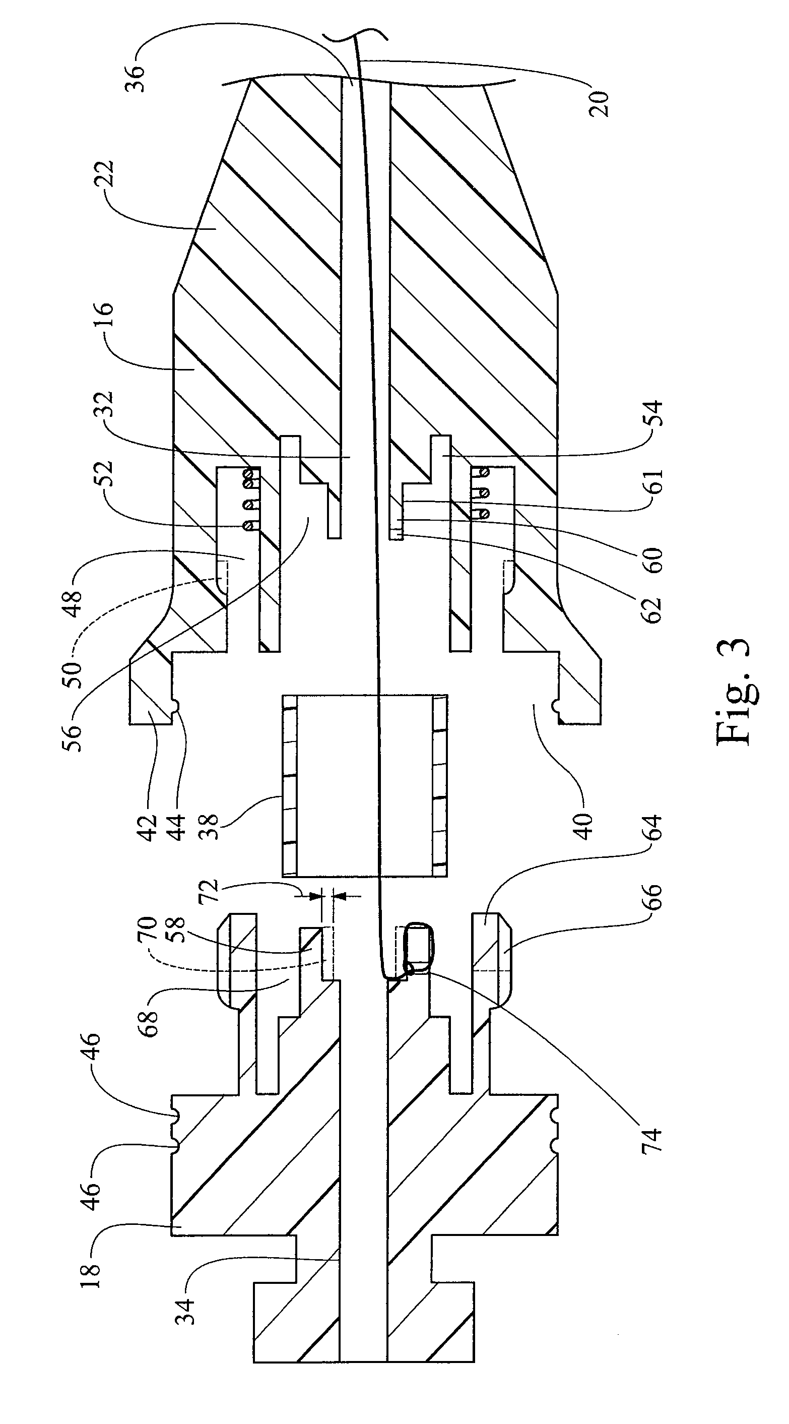 Suture winding for a drainage catheter