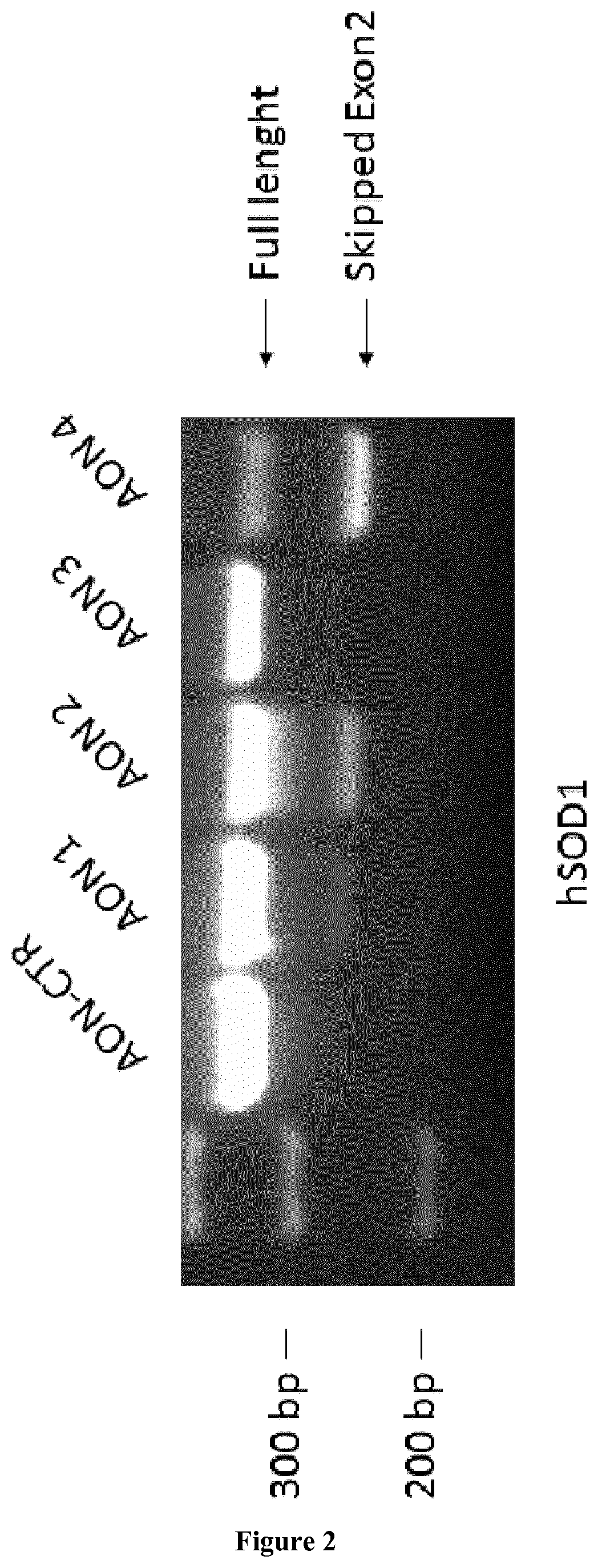 Treatment of amyotrophic lateral sclerosis