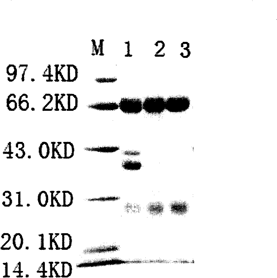 Anti-vibrio parahaemolyticus chicken yolk antibody, preparation method and application thereof