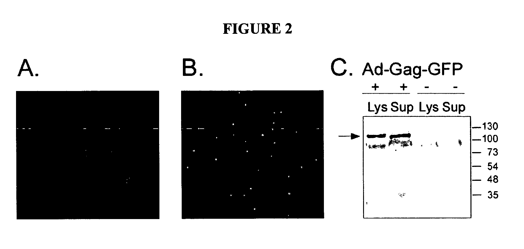 Lipoparticles comprising proteins, methods of making, and using the same