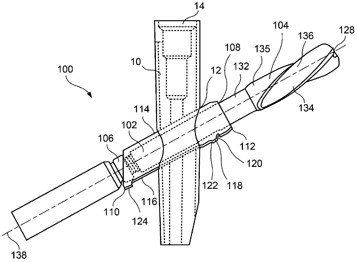 Trochanteric femoral nail augmentable