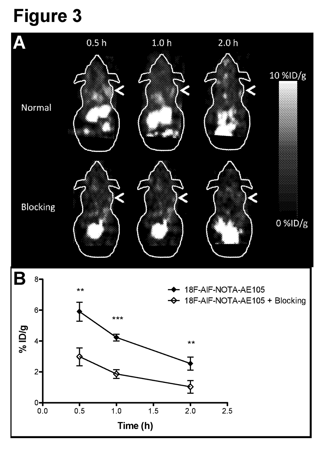 Positron emitting radionuclide labeled peptides for human uPAR PET imaging