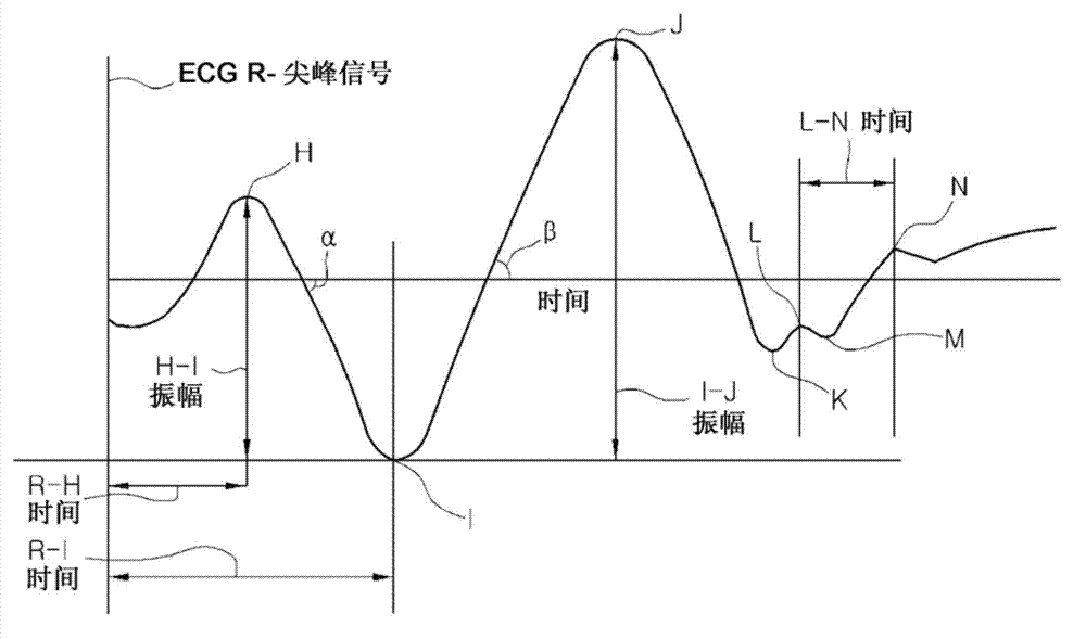 Ballistocardiogram analysis apparatus and method, and system for utilizing ballistocardiogram for vehicle using the same