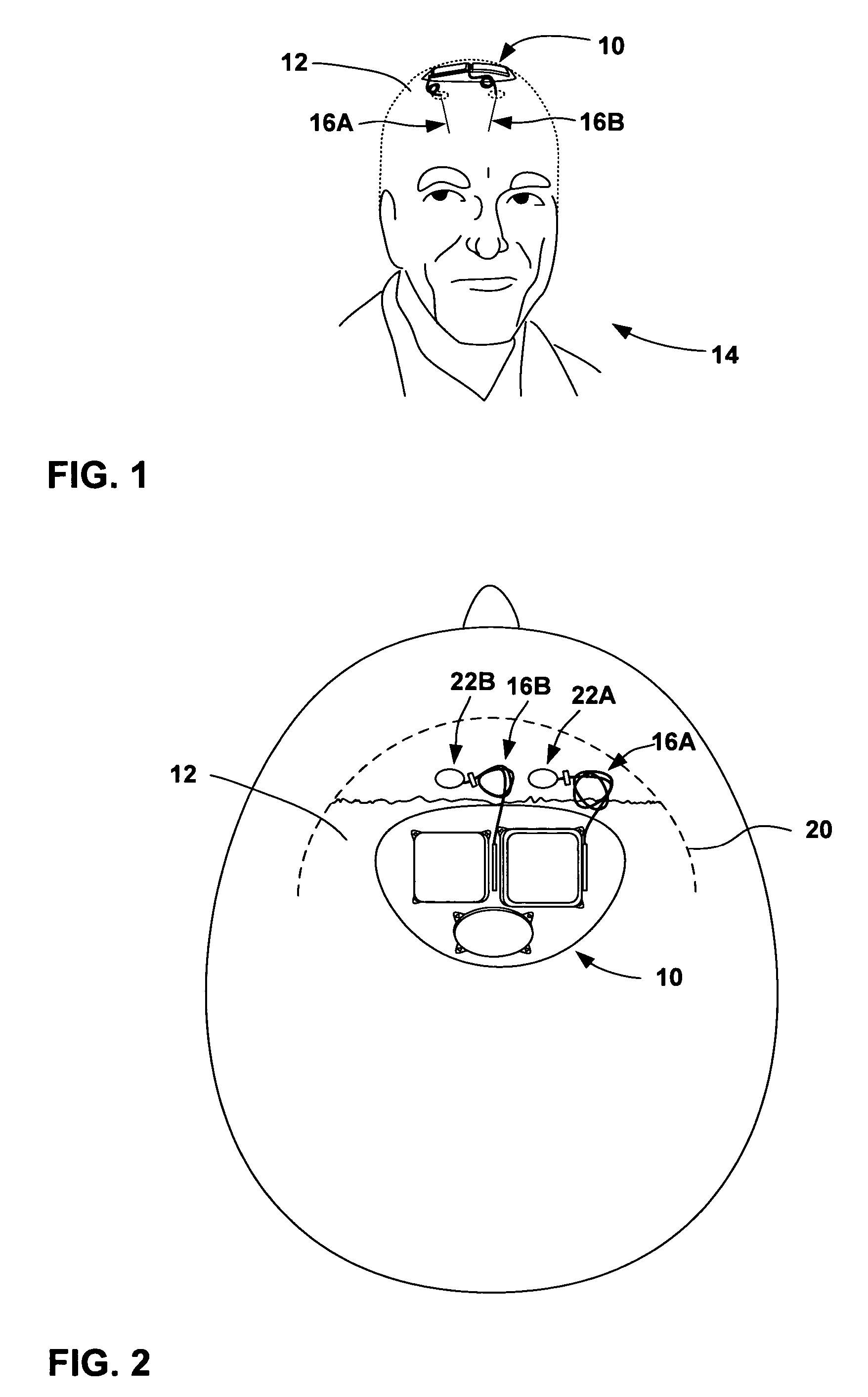 Implantable medical device with a nonhermetic battery