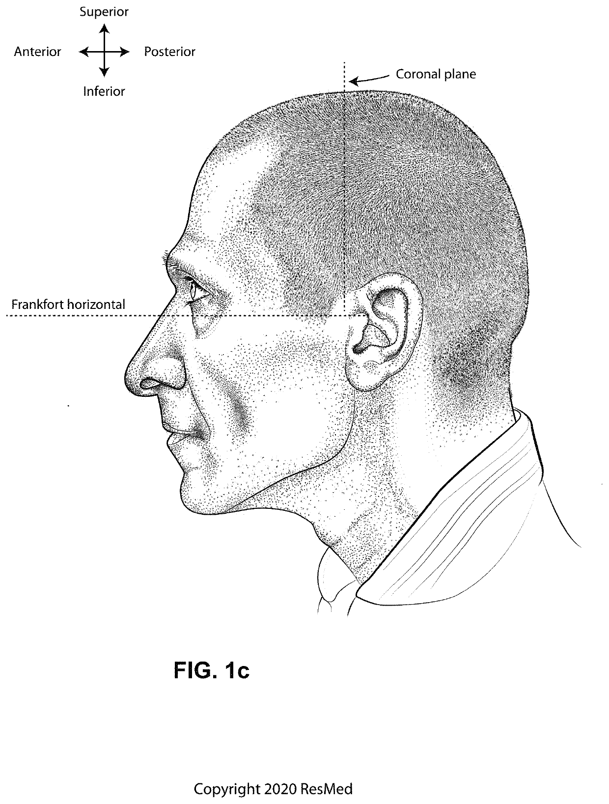 Positioning, stabilising, and interfacing structures and system incorporating same