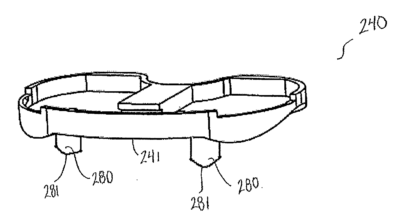 Prosthetic implant and associated instruments