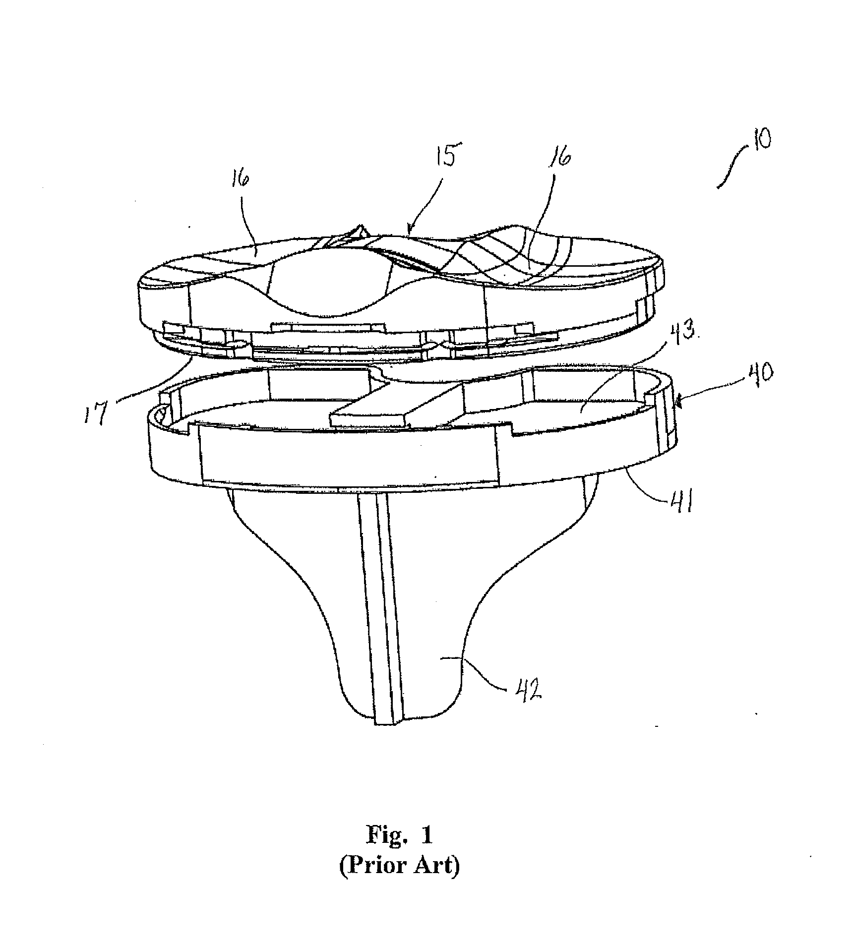 Prosthetic implant and associated instruments