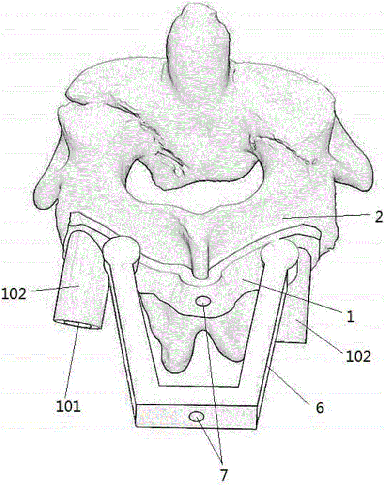 Cervical pedicle screw feeding guiding formwork and preparation method thereof