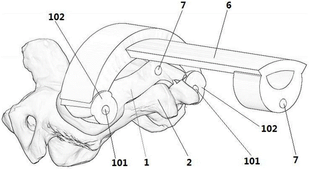 Cervical pedicle screw feeding guiding formwork and preparation method thereof