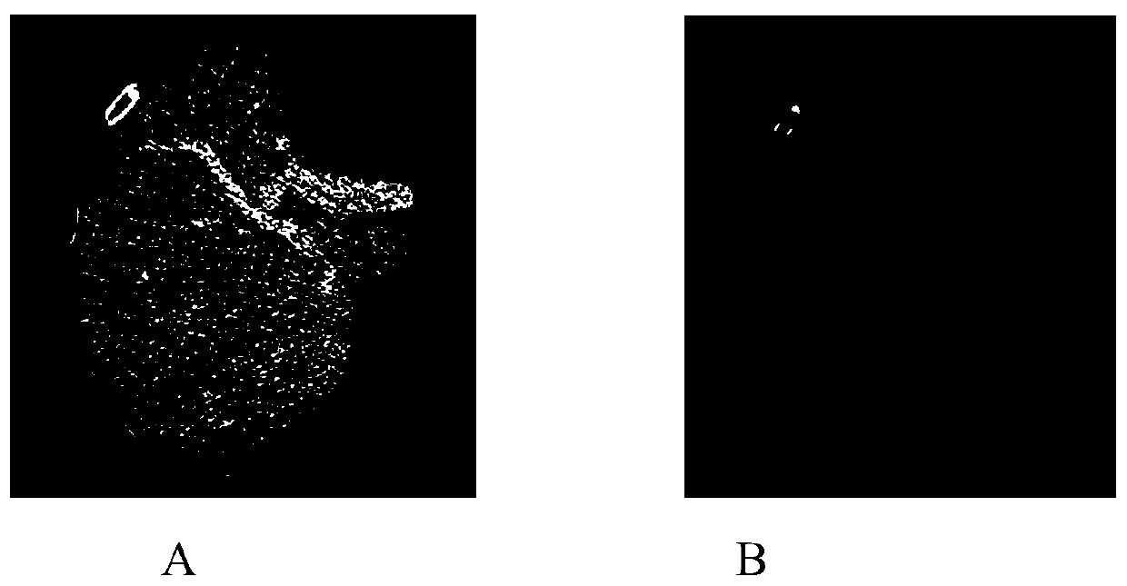 An Automatic Extraction Method of Organ Vascular Tree Based on Statistical Information